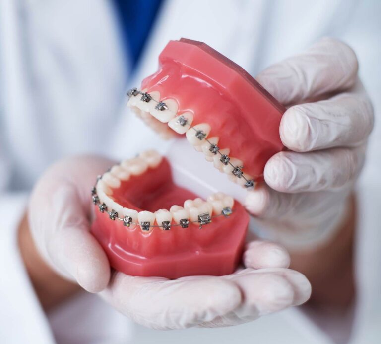 close up of doctor holding model of braces on teeth
